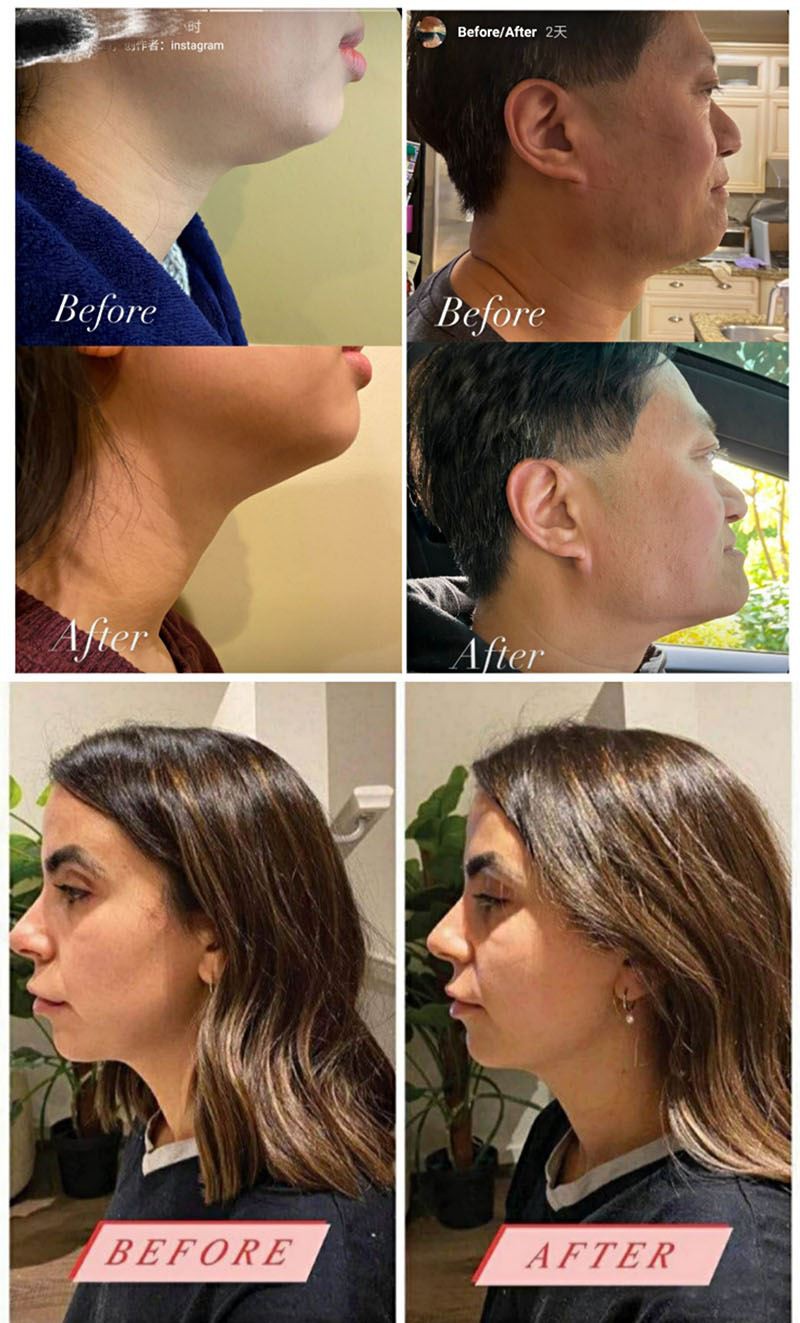 Customer’s Feedback