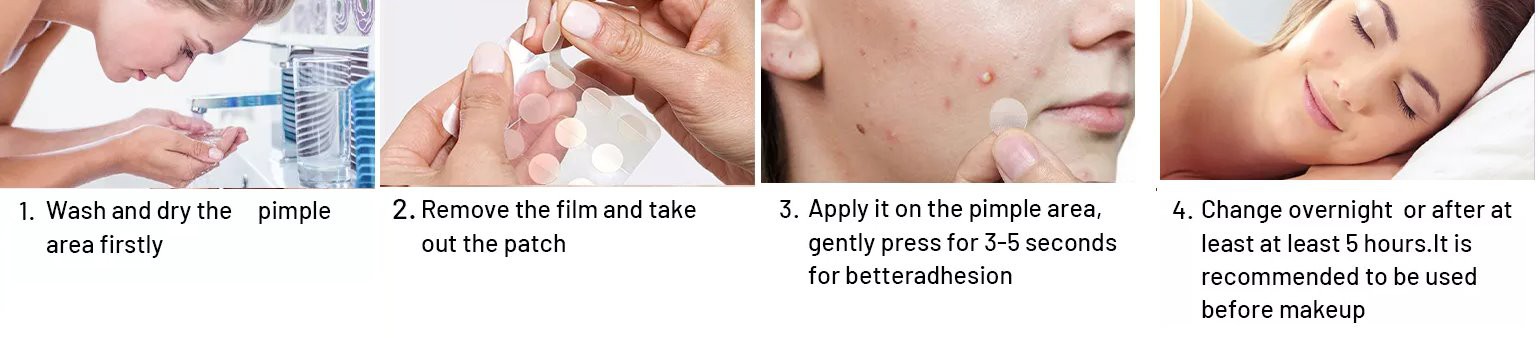 pimple patch pimple patch
