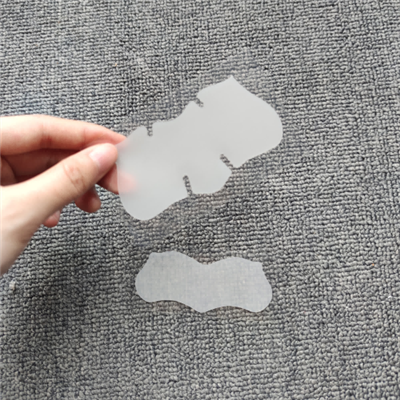 Траке за нос Уклањање митесера